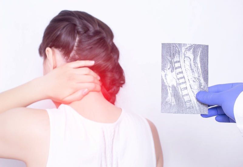 A woman needs cervical myelopathy treatment from Dr. Salvatore Palumbo on Long Island