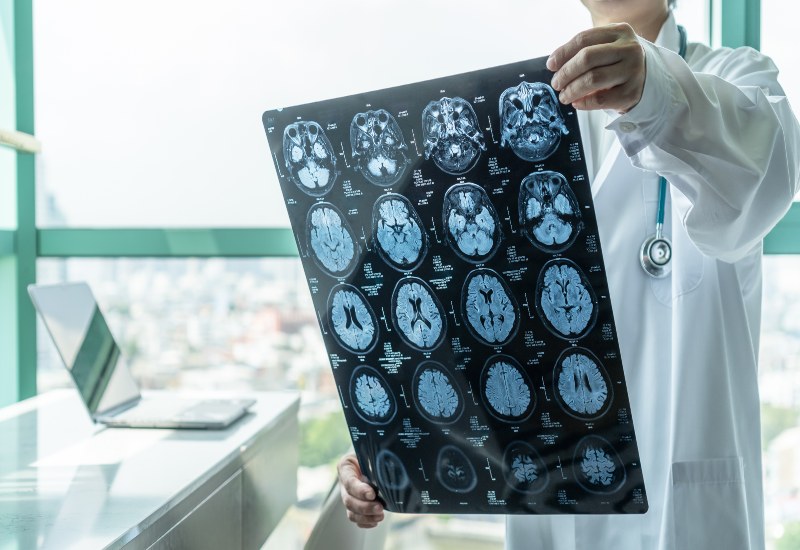 Dr. Salvatore Palumbo offers effective neurosurgical conditions treatments on Long Island
